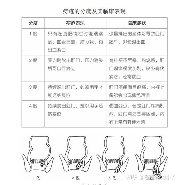 便血不一定是痔疮 - 知乎