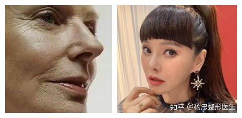 面部年轻化乘风破浪的姐姐我pick52岁的伊能静