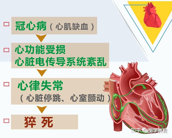 猝死很可怕?有些猝死是可以避免的,要引起重视! - 知乎