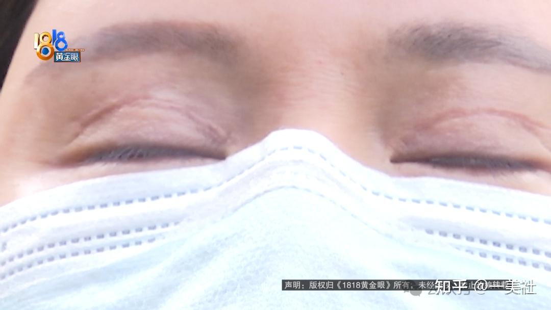割双眼皮多出分叉线、抽脂后凹凸不平 维多利亚医美客诉不断(图8)