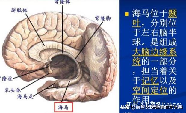 张光明:颞叶是功能非常复杂的脑叶,因此颞叶癫痫也成为常见的发作类型