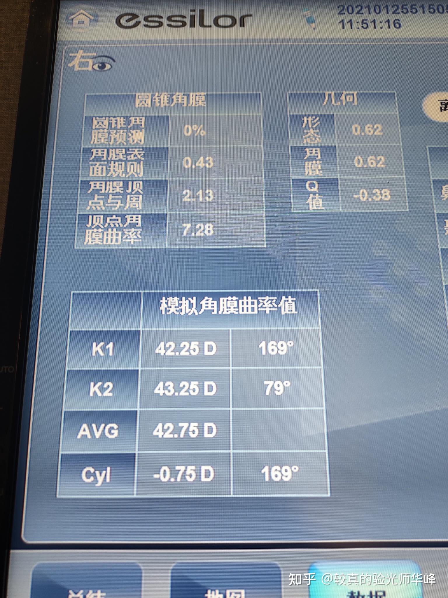 7415晶體無明顯渾濁右是近視100度散光50軸150,左眼近視125度散光