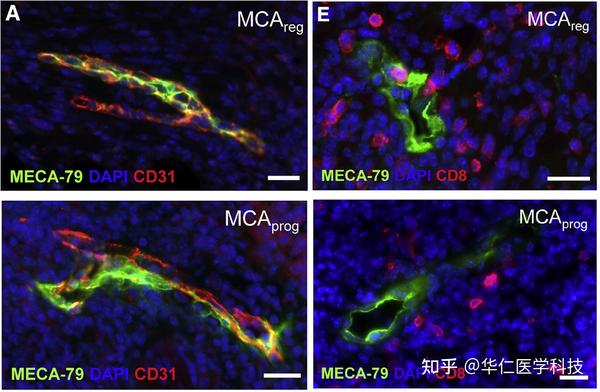 Dapi Cd8 肿瘤浸润性T细胞拥有进入肿瘤内部的特殊通道 - 知乎