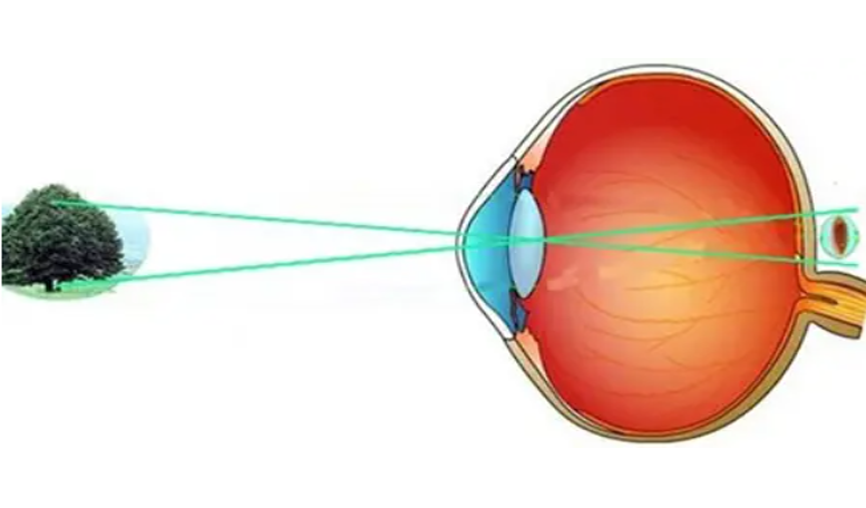 所以视力=1/视角.