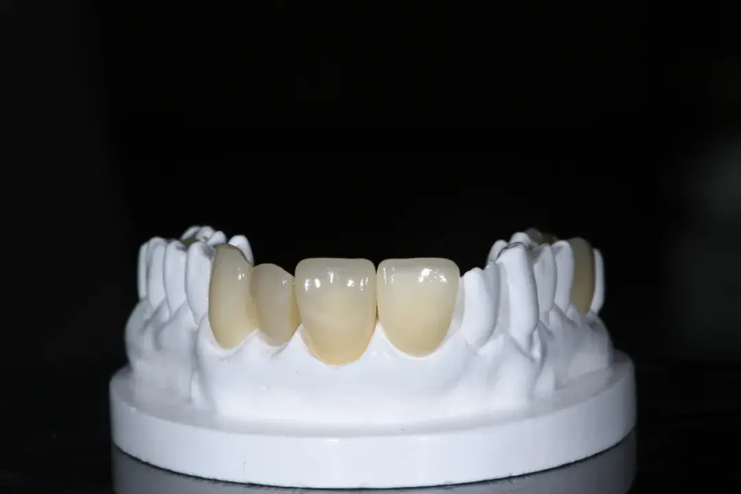 文末惊喜爱迪特科美玻璃陶瓷为什么这么受欢迎