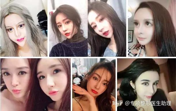 整容脸vs自然脸到底选哪个