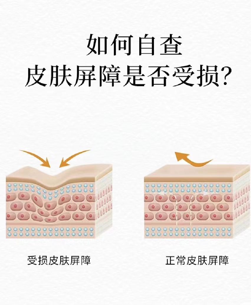 夏季干皮&油皮怎样护肤？建议收藏！ - 知乎
