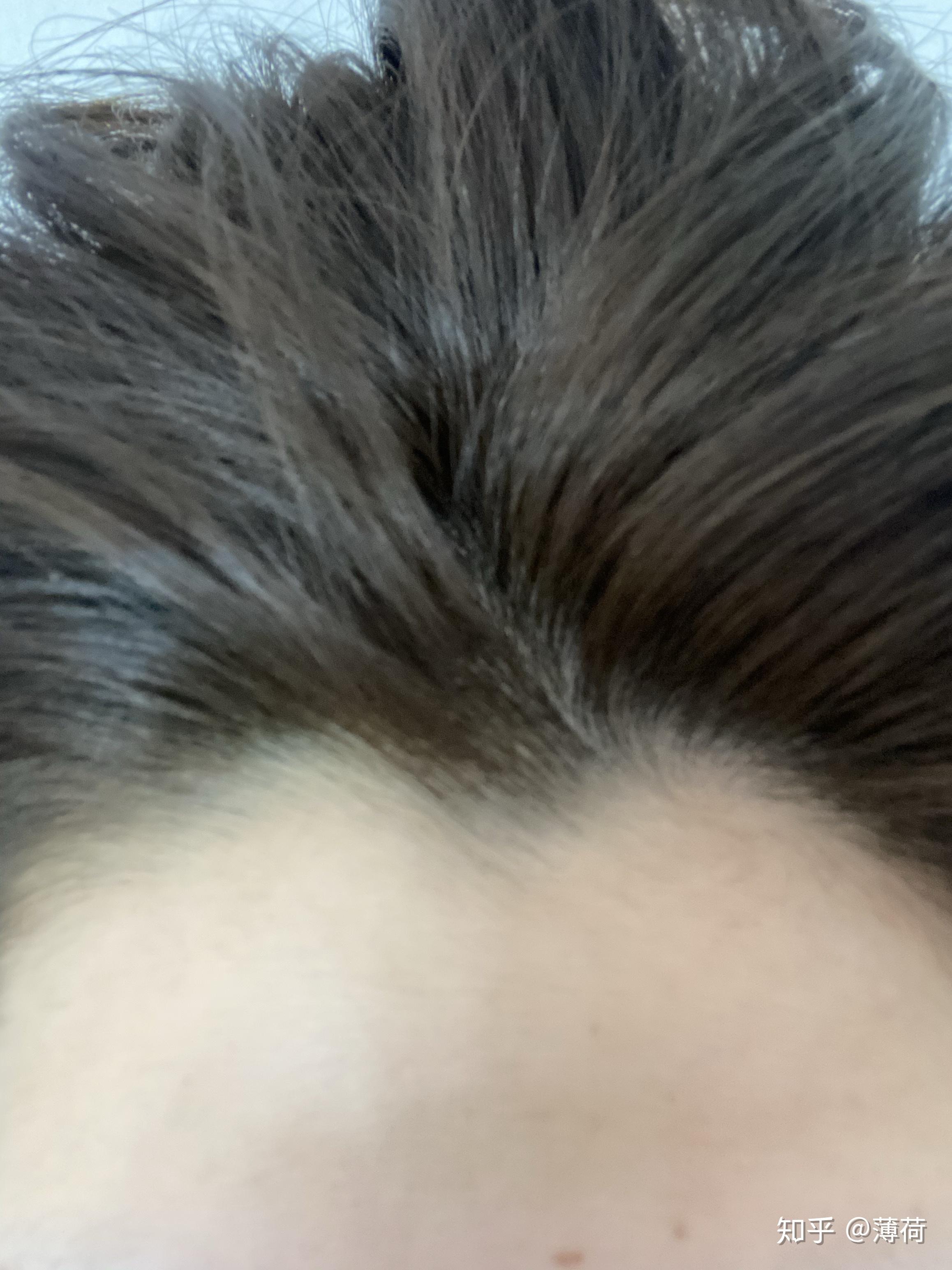 有美人尖的女生都会漂亮吗