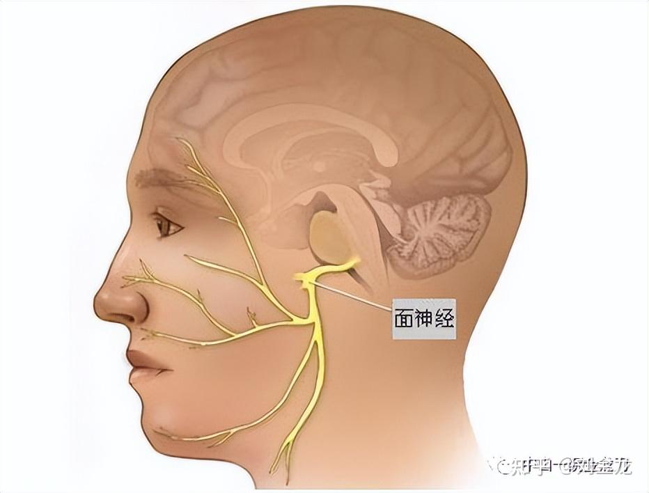 在面肌痉挛的治疗方法中