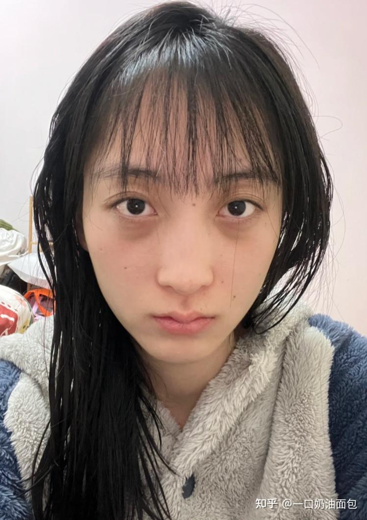 女生气血不足,黑眼圈重怎么快速改善?