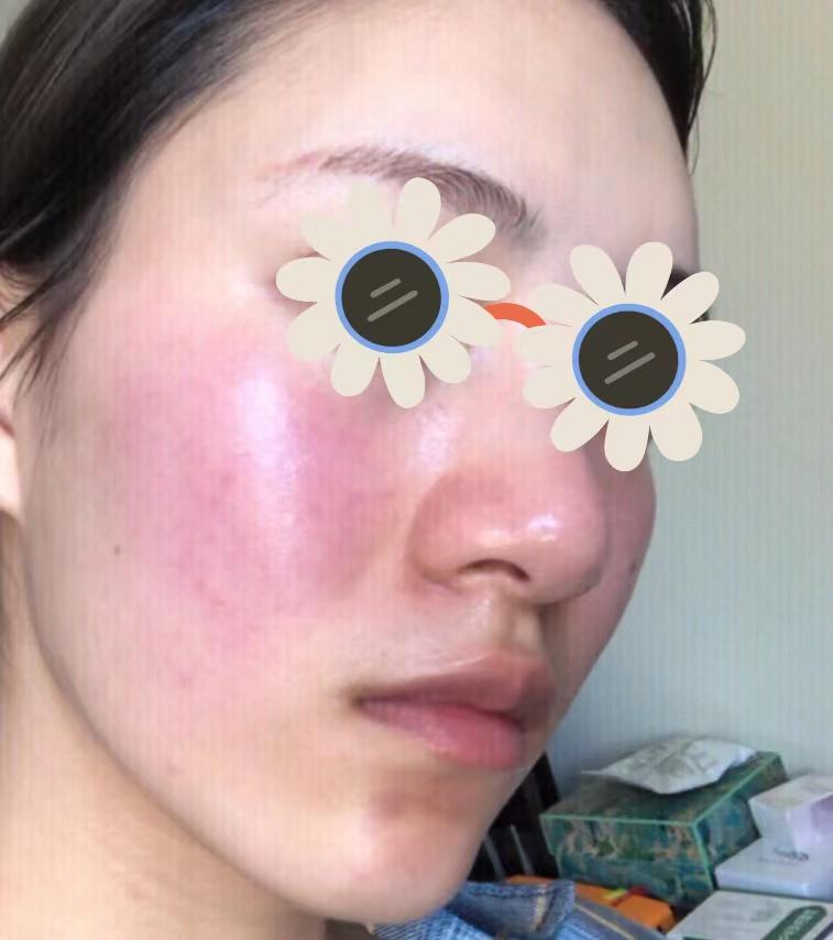 就因为这大红脸都不知道阻挡了我多少桃花!