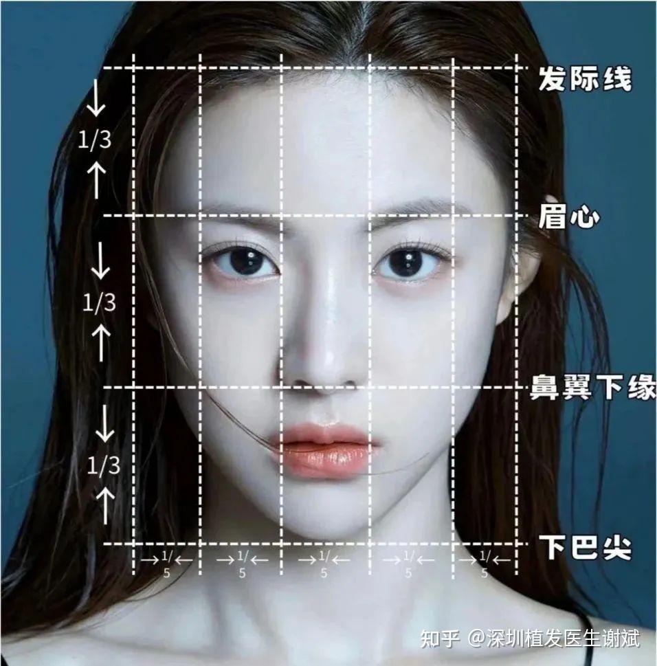 发际线植发,如何避免生硬不自然的发际线? - 知乎