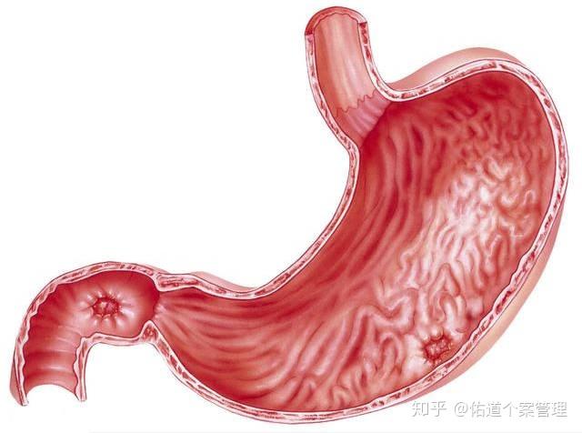 胃的縫合口還需要時間來恢復,相對來說比較脆弱,所以在飲食方面要多加