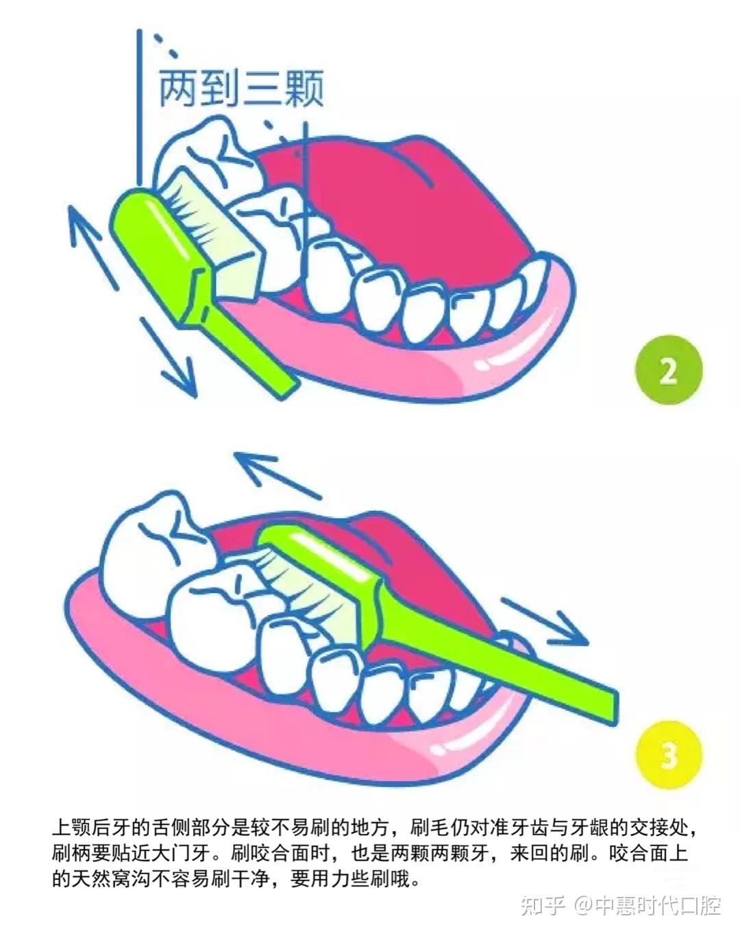 3,第三步,刷牙齒咬合面刷咬合面時,是兩顆兩顆牙,來回地刷,將牙刷傾斜