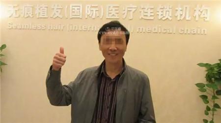 发际线高做植发手术效果是永久的吗? - 周宗贵