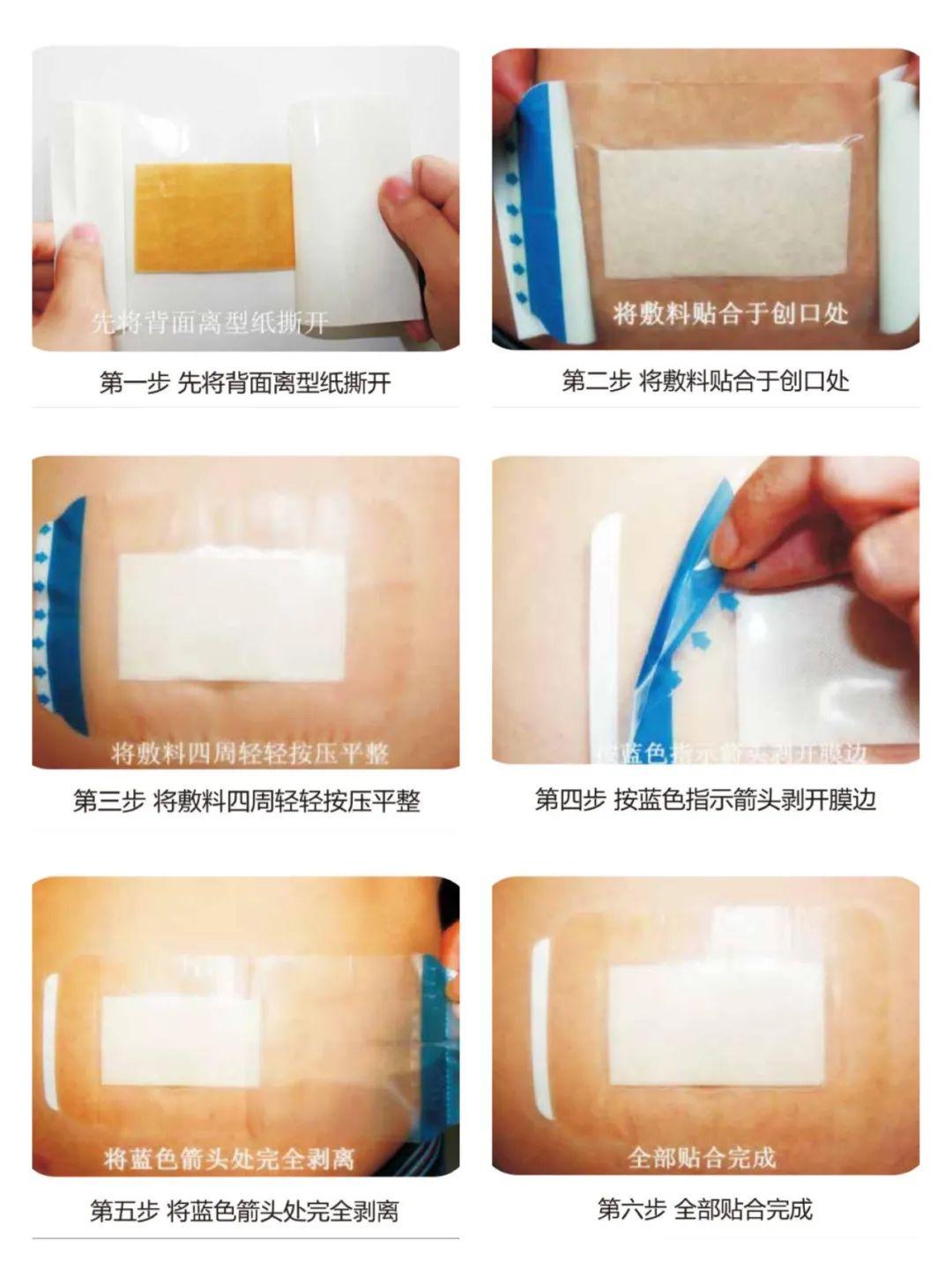 壳聚糖抗菌敷贴（90mm×100mm）-安徽省小山卫生材料有限公司