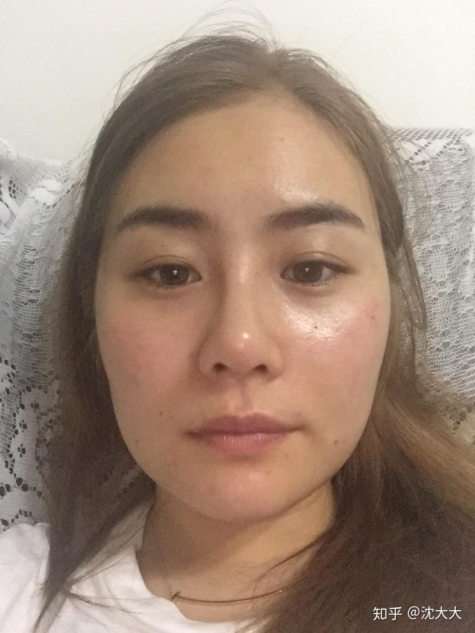 怎么拯救两边脸严重不对称?