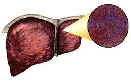 肝豆状核变性基因检测最快多久出结果