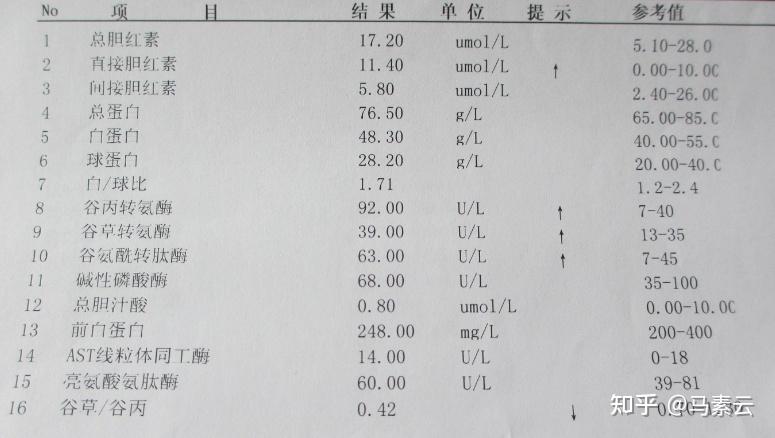 v2-a68bb100006d77643d1c6cf80678d39e_r.jpg