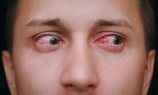 不过,一片血红看似惊人,但其实就跟腿部撞到瘀血一样,毋须太过担心.