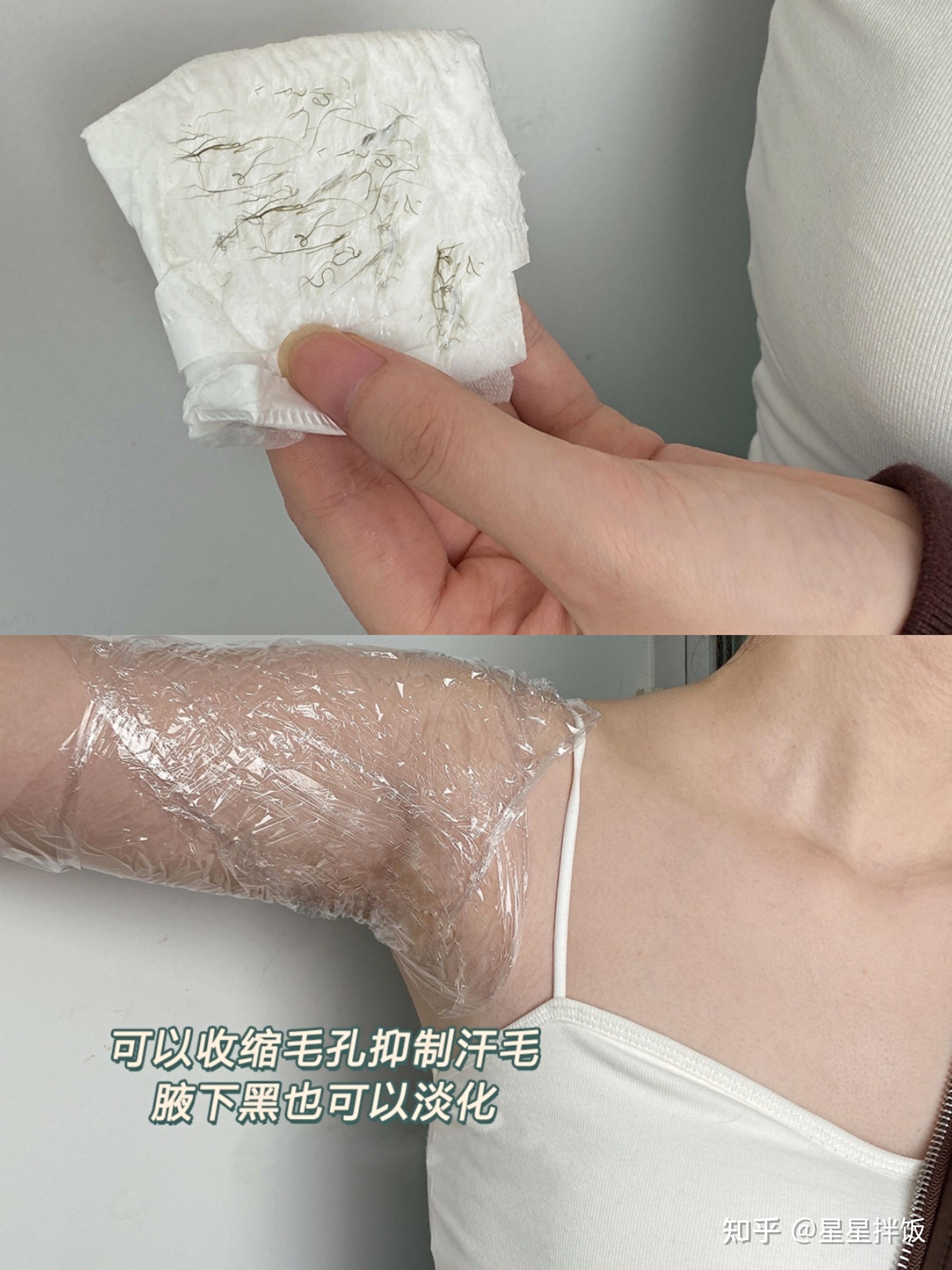 腋下怎样把腋毛脱干净而且能去掉黑色素