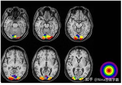 How Brain Activity Is Measured - 知乎