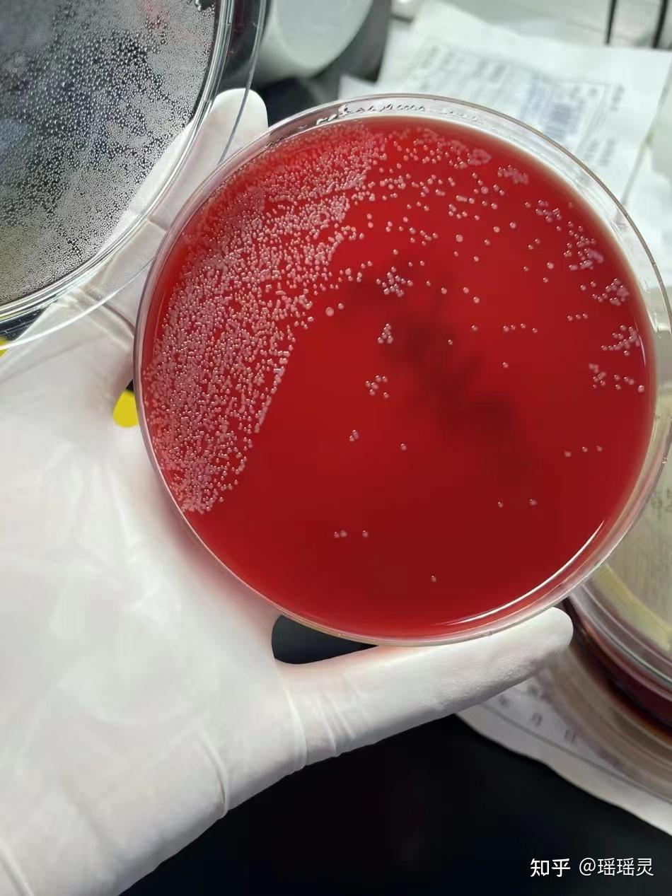 重度脚臭脚痒去了趟医院才知道,原来真菌感染两周就能解决!