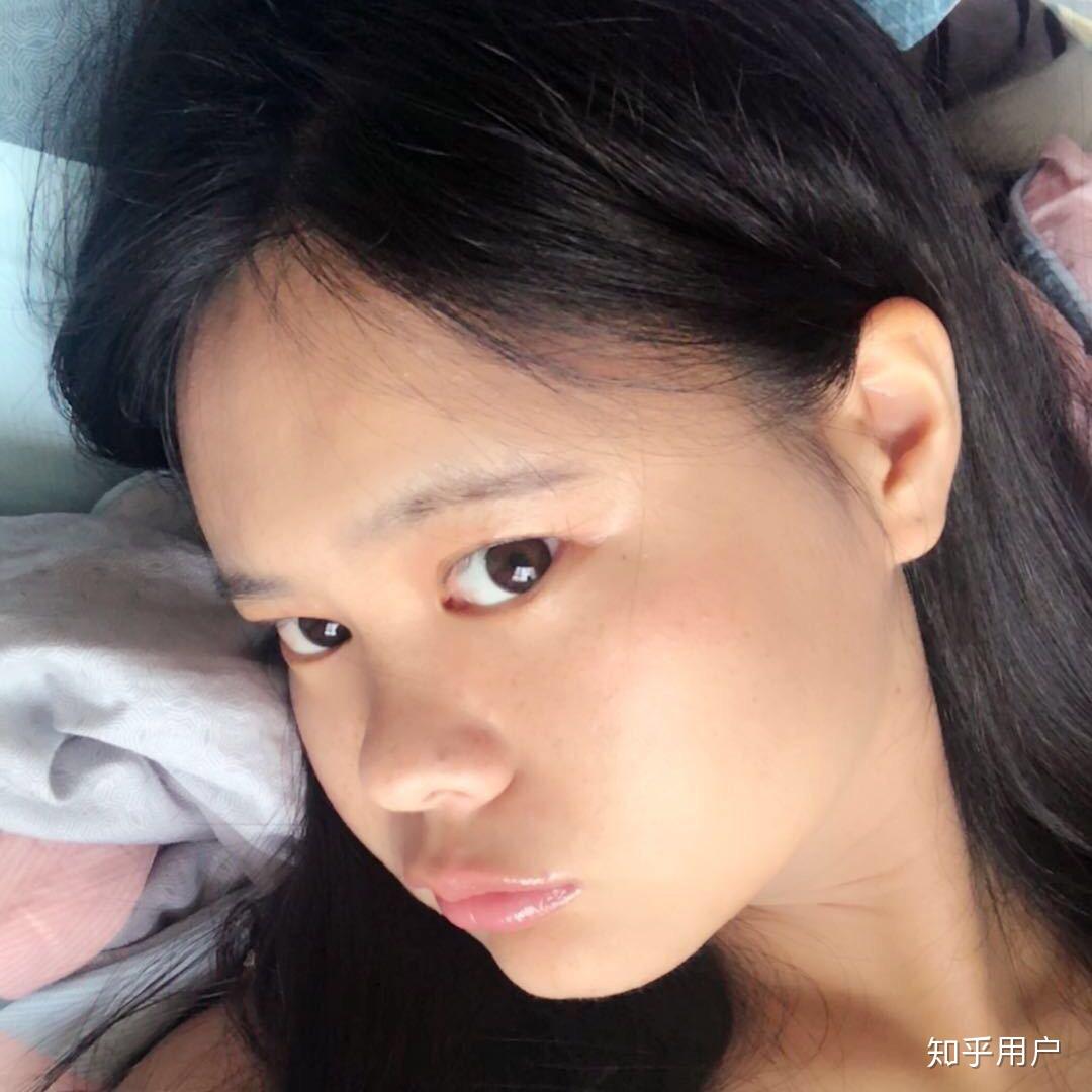 你见过蒜头鼻的美女吗