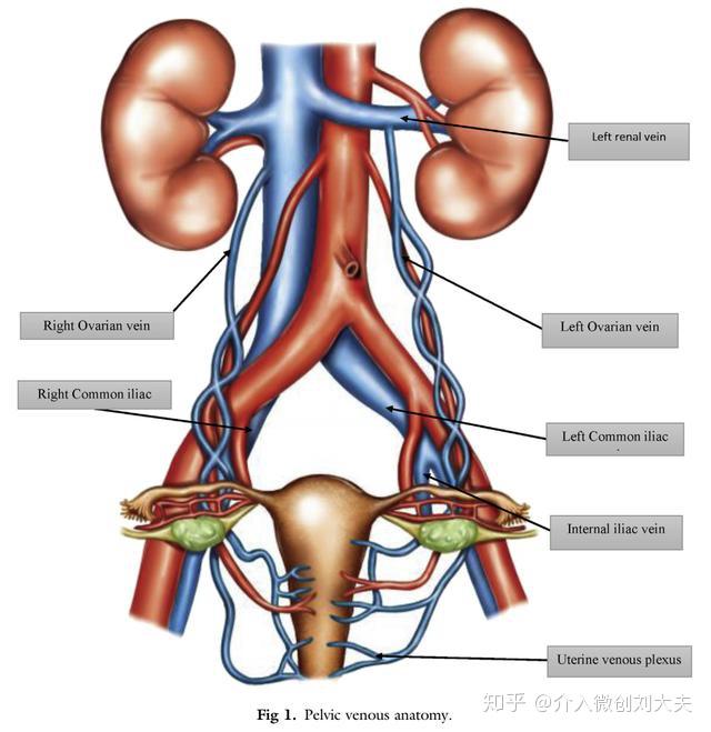 卵巢静脉汇入解剖图图片