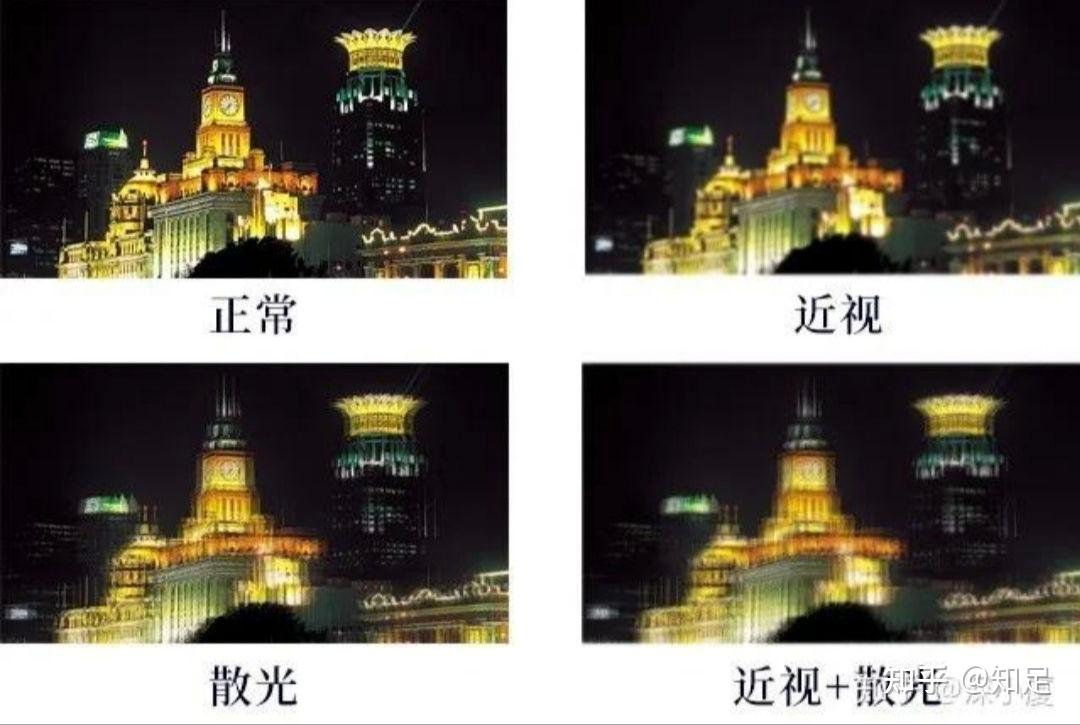 散光形成、影响及矫正 - 知乎