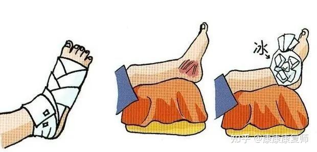 常见运动损伤的原因及处理