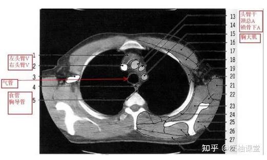 教你读懂胸部CT - 知乎