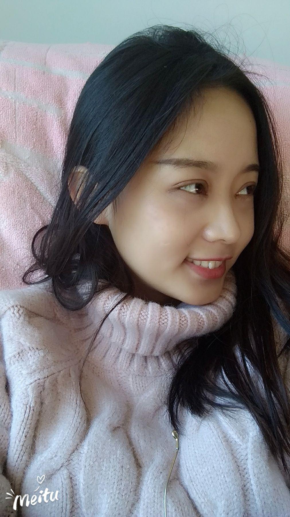 双眼皮 全切6mm&开眼角 - 知乎