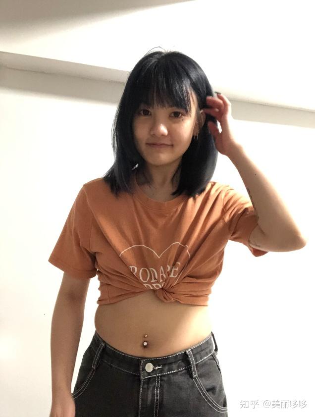 广州专家案例反馈医生专做吸脂塑形手术,对面部吸脂,臀部吸脂,小腿