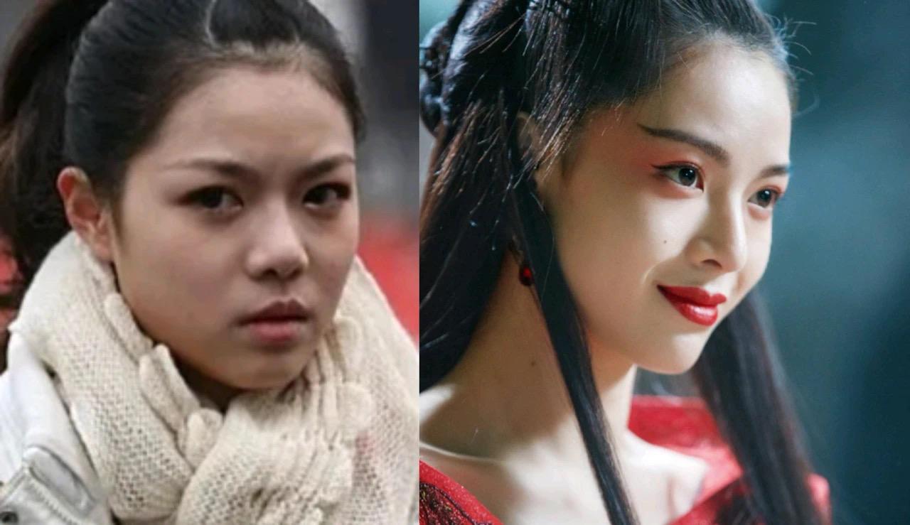 纵观她的do脸历程,普通人可以借鉴什么?钟楚曦美商揭秘!