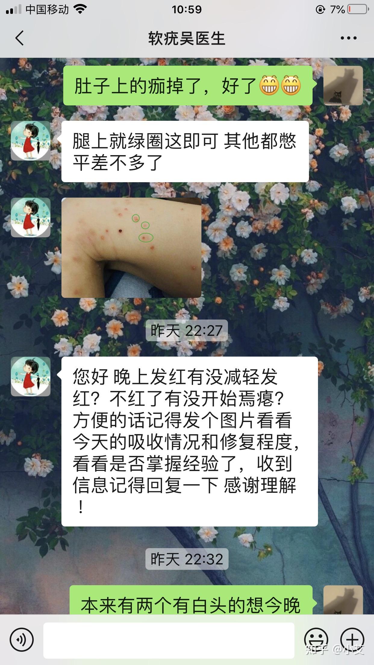 儿童传染性软疣病程