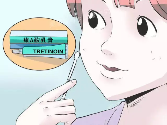 刷酸是什么换脸还是烂脸女生看过来