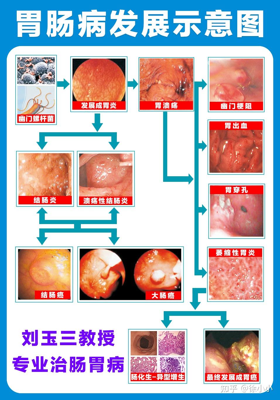 肠胃炎挂号挂哪科好(肠胃炎应该挂号什么科)