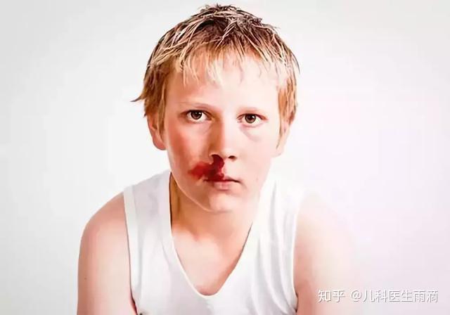 孩子经常流鼻血是因为患上白血病 正确的预防和处理方法全攻略 知乎