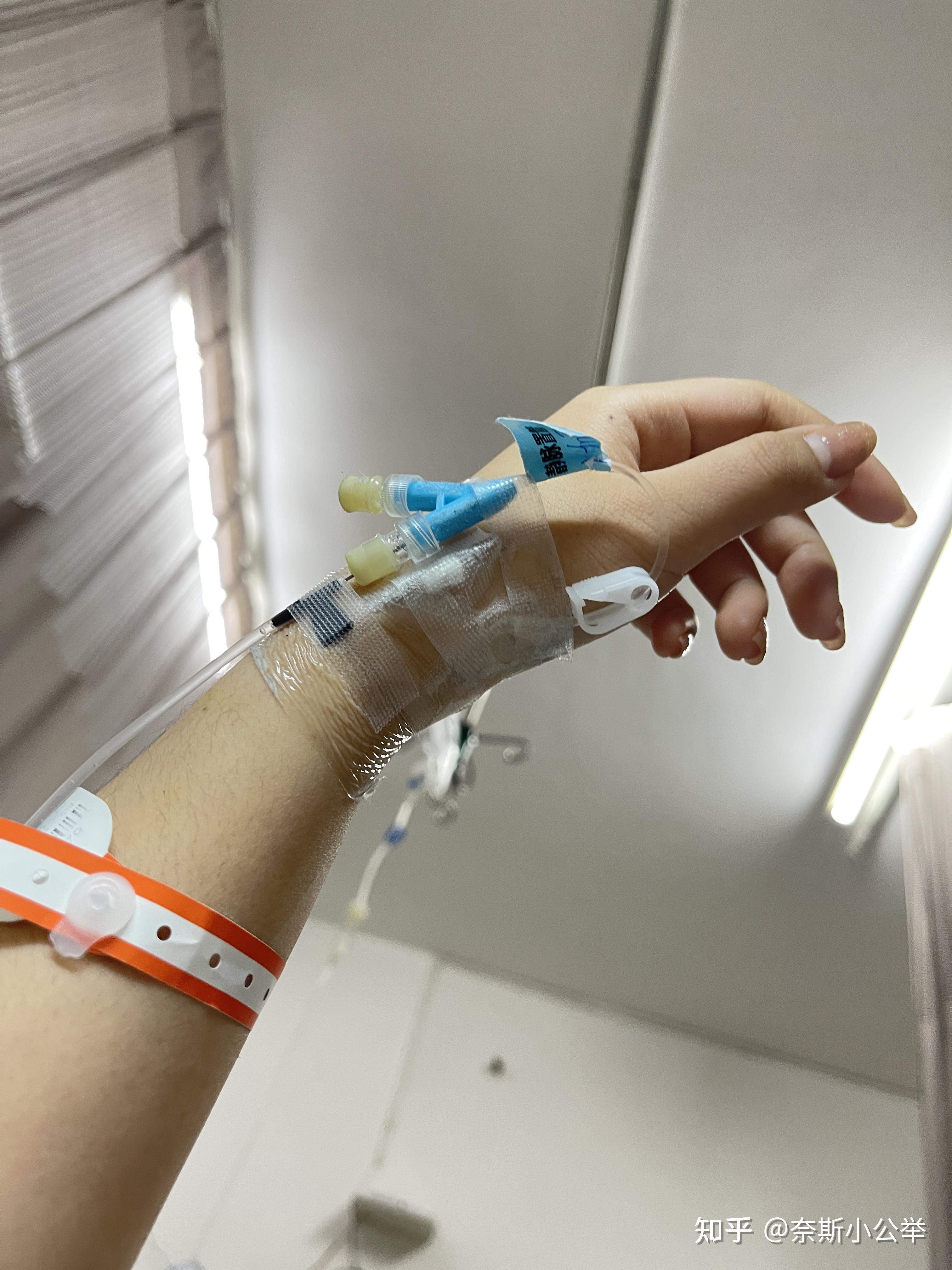 菊花保卫战肛周脓肿到肛瘘