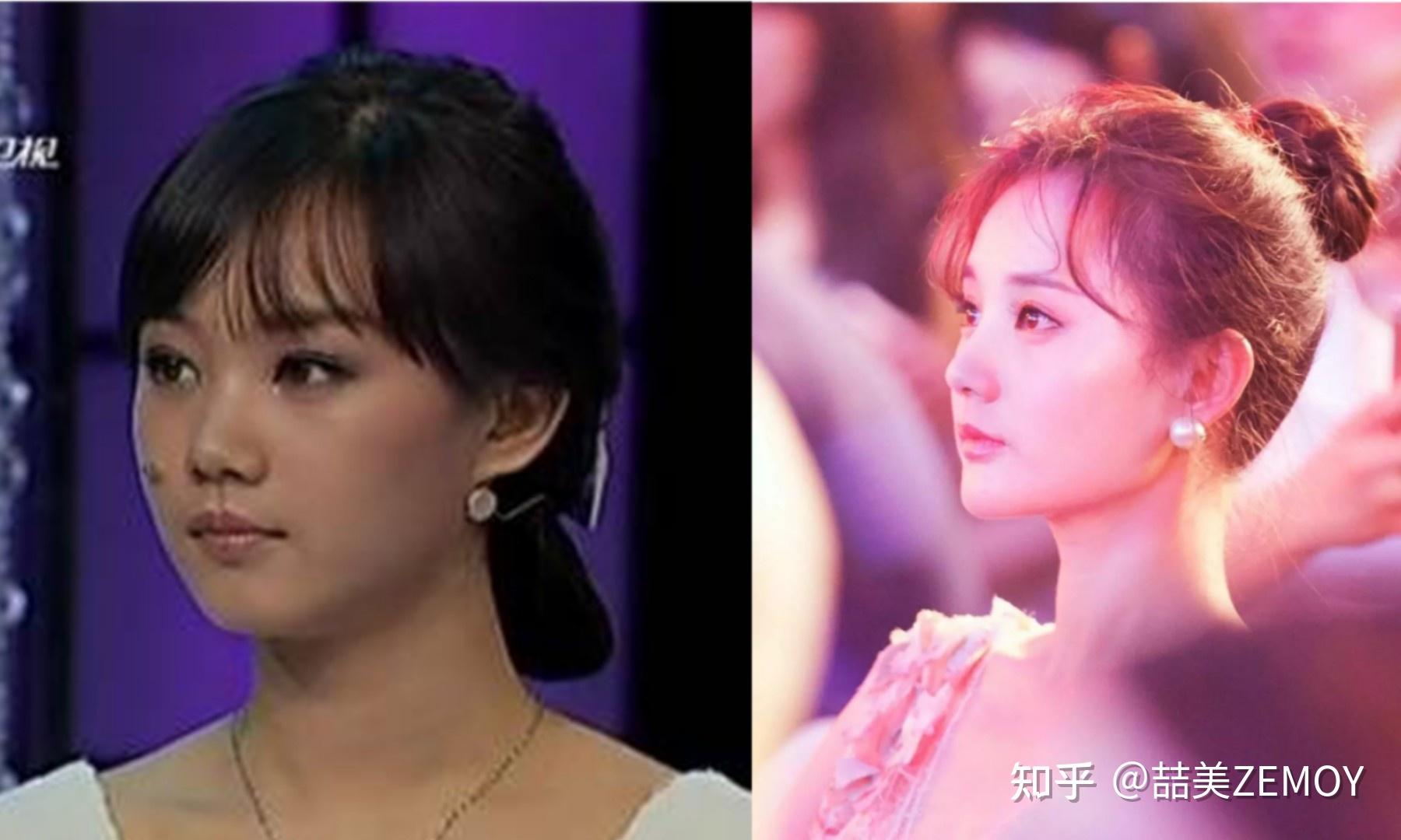 狂飙里孟钰的包15万,那么脸花了多少钱? - 知乎