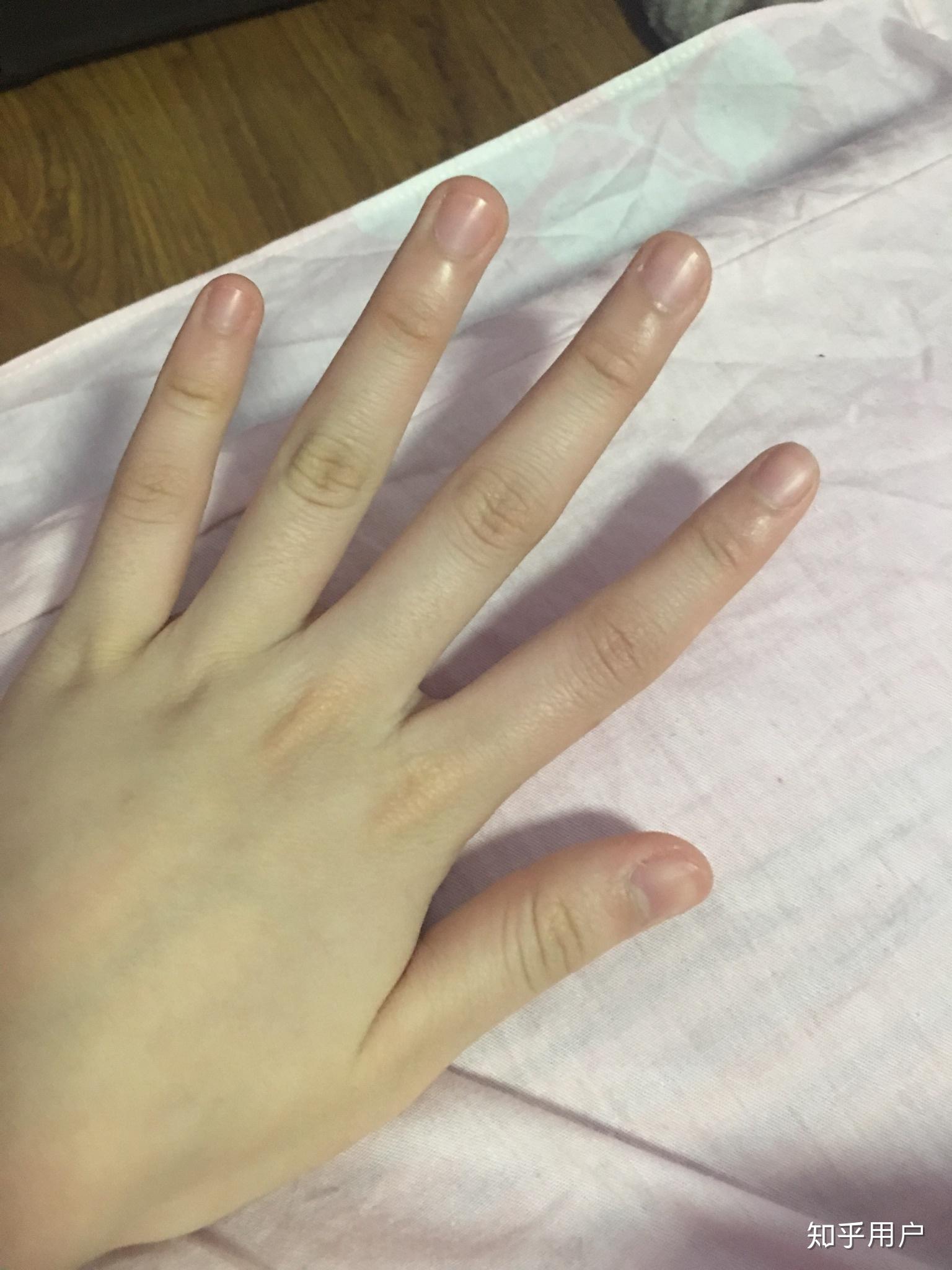 手指好看指甲不好看是什么体验