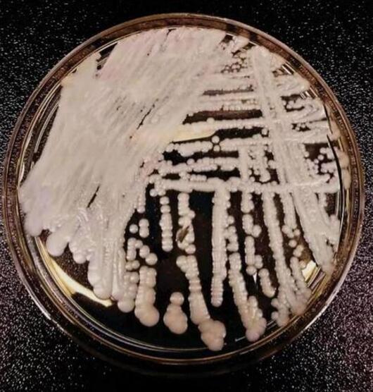 中国已有 18 例确认感染的「超级真菌」耳念珠