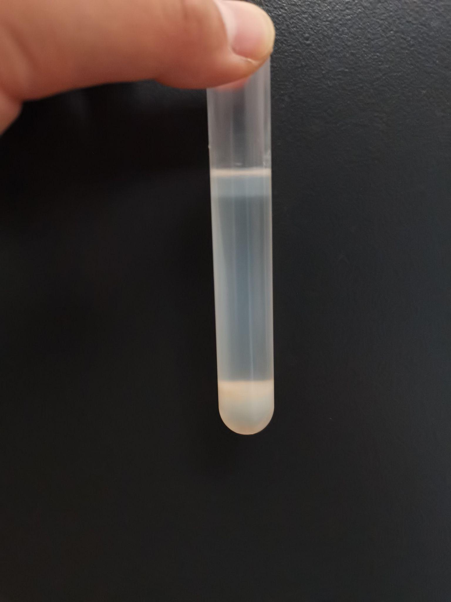percoll分离线粒体后最下层为胶样为什么