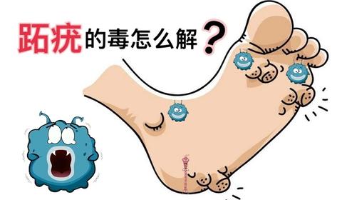 如何有效的治疗刺猴呢? - 知乎