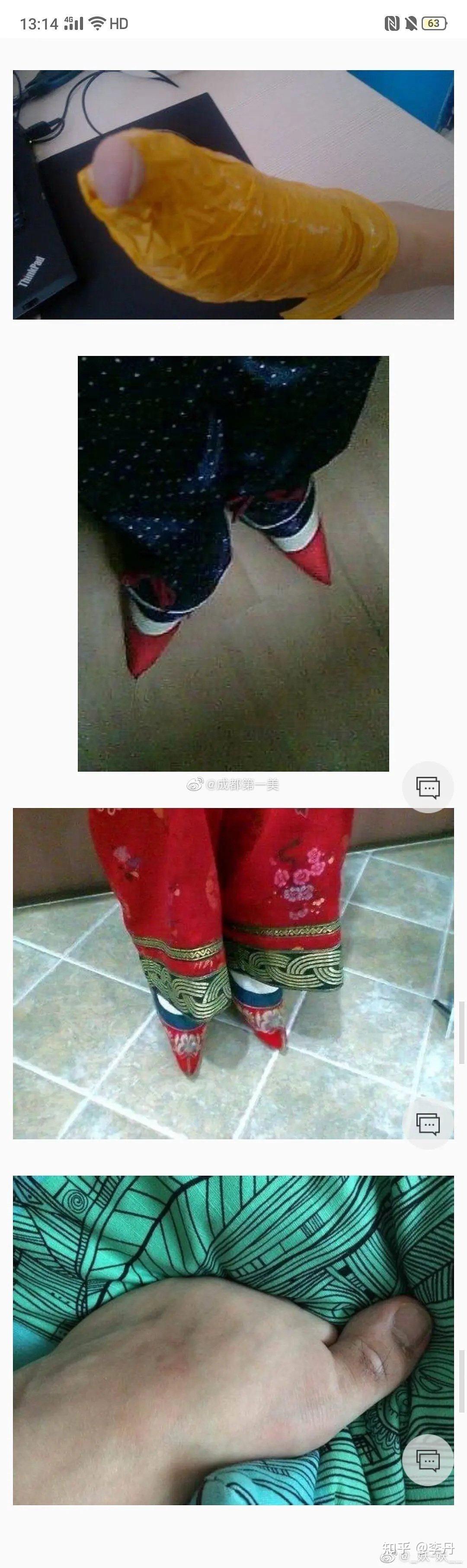 现代缠足---触目惊心,三观尽毁