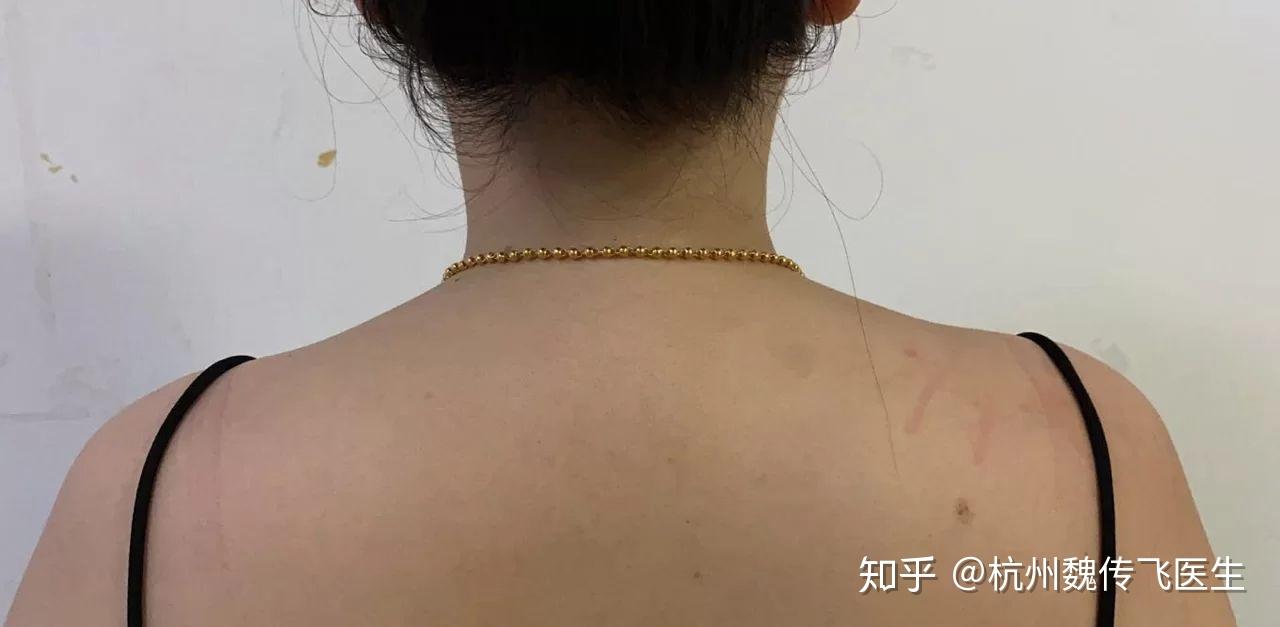 富贵包该如何改善?