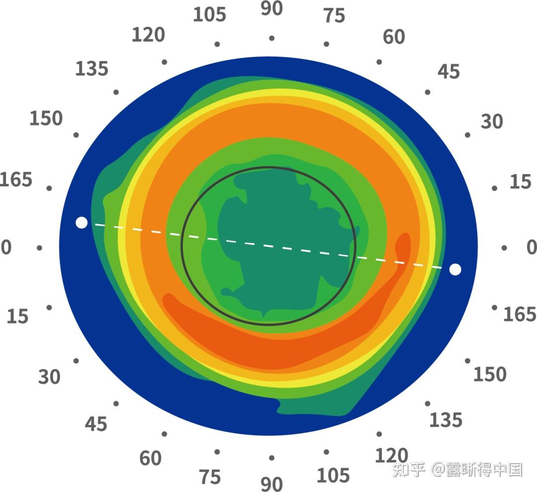 角膜地形图英文图片
