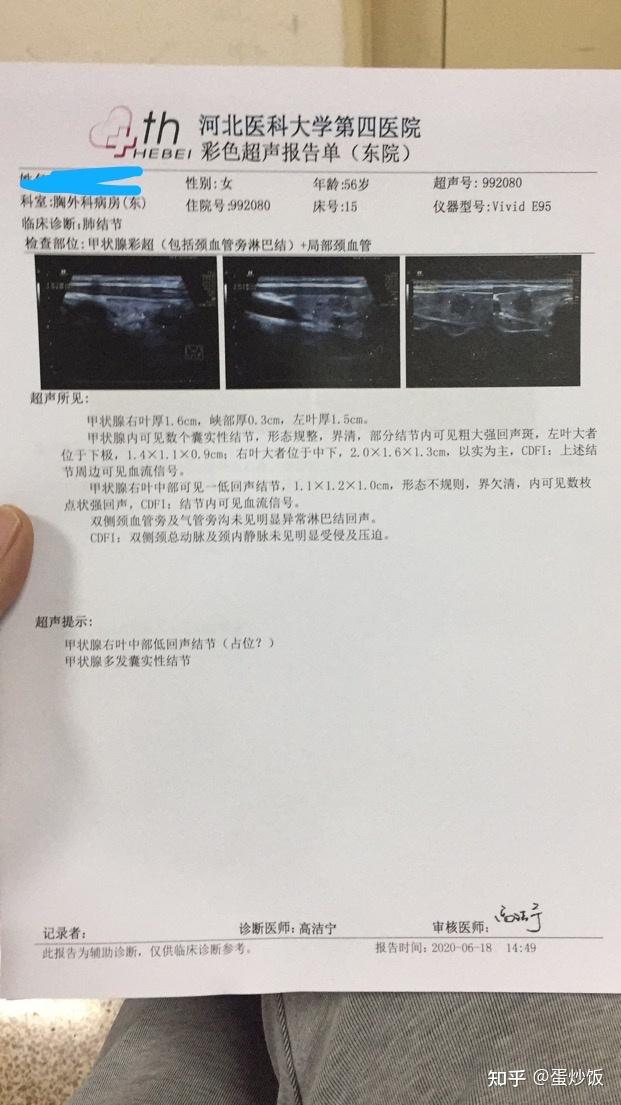 还没做甲状腺乳头状癌手术的请看看再决定吧