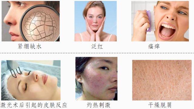 v2-aa224c39cfab7cc49218fed3df38495b_1440w.jpg?source=172ae18b